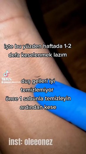 Exploring Skin Sample Extraction Techniques