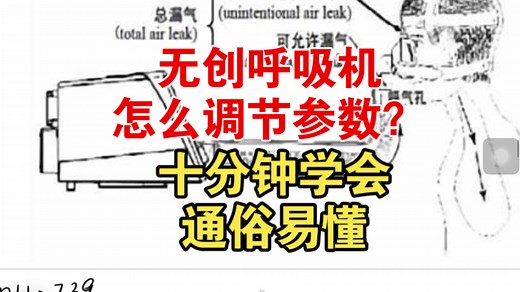 无创呼吸机BiPAP模式，参数怎么调节？手把手教你，通俗易懂