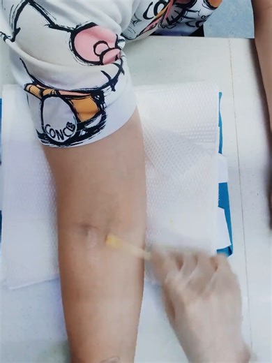 Perfect Blood Draw Techniques for Nurses