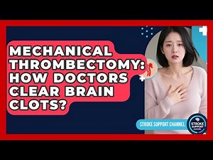 Mechanical Thrombectomy: How Doctors Clear Brain Clots? - Stroke Support Channel