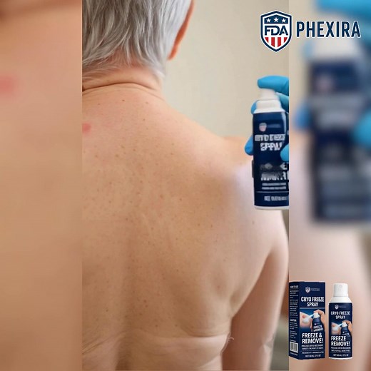 Covering up skin tags, warts or moles every day? 😔 ❄️ WartErase Cryo Freeze Spray ⚡ -55°C precision freezing removes in 10-14 days 🌿 95% saw visible improvement within 10 days ✨ No pain, no scars, no expensive clinic visits Professional cryotherapy technology at home. FDA-approved medical-grade formula. 60,000 Americans already trust it. Fast shipping across the USA. | Banz Ryan Maria