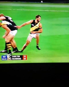 14K views · 155 reactions | Ever needed evidence that the ACL helps prevent anterior translation of the tibia? Watch this athlete's right tibia closely after landing. (Highly likely) ACL rupture followed by the tibia sliding forward into the skin! | Physio Digest | Facebook