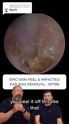 Impacted Ear Wax Removal and Skin Peel | Part 5 - Audiology Associates
