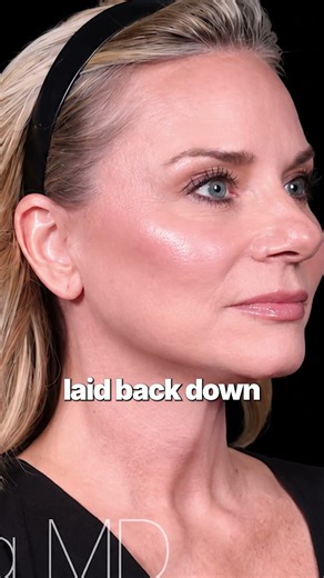 Why Modern Facelifts Don't Look Fake