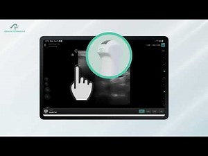 Apache Feature Introduction