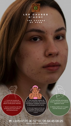 6K views · 21 reactions | Comprendre les causes de l'acné est...