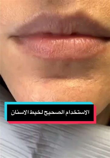 الاستخدام الصحيح لخيط الاسنان الطبي