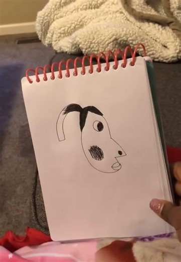 Funny Hyperpigmentation Trend Explained