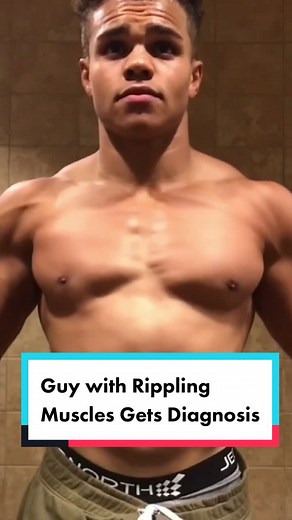 Best of #TheDoctors: Guy with rippling muscles gets diagnosis! #fyp #foryoupage #bodybuilder #viral #edutok #tiktoktaughtme #medicaltiktok