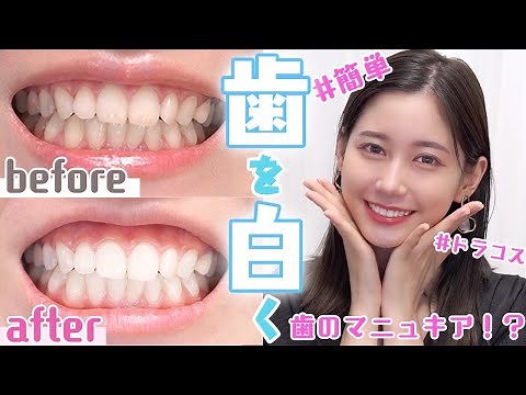 【超簡単】家で歯を確実に白くする４つの方法を全部やってみたらすごい結果になった…！！【セルフホワイトニング】