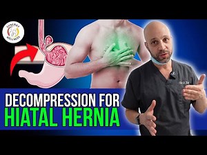 Pull Stomach Down From Diaphragm using Decompression for Hiatal Hernia