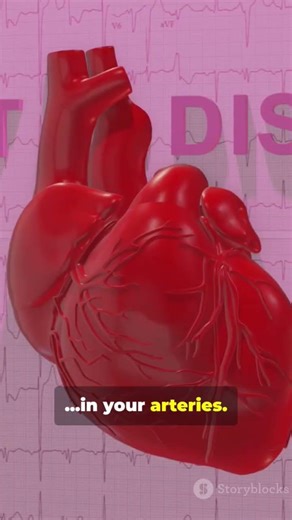 How a Heart Attack Actually Happens 💔 (3D Animation)