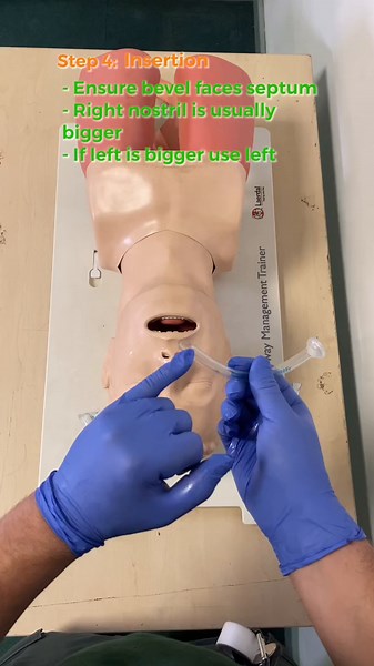 How to Insert a Nasopharyngeal Airway (NPA) | Step-by-Step Guide