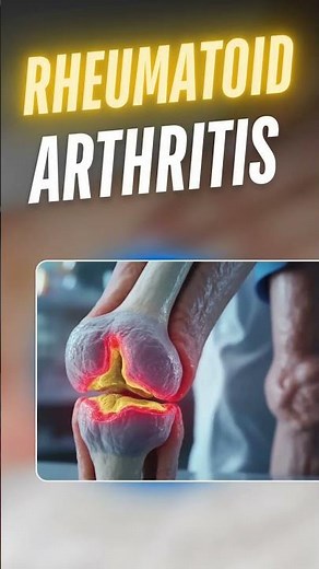 Don't Ignore Body Stiffness: Understanding Joint Pain and Symptoms | Dr. Himanshu Gaur