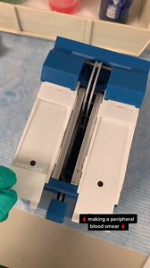 446K views · 5.3K reactions | Automated blood smear preparations  #lablife #hematology | Lab life | Facebook