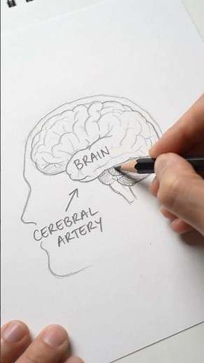What Happens Inside Your Brain During a Cerebral Aneurysm?