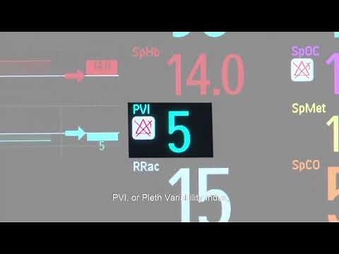 Masimo rainbow SET parameters