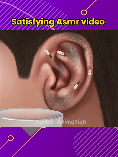 Ear 👂 Cleaning And Treatment Asmr Animation [Asmr Satisfying Video] #asmr #animation #eartreatment #cleaning #viraltiktok