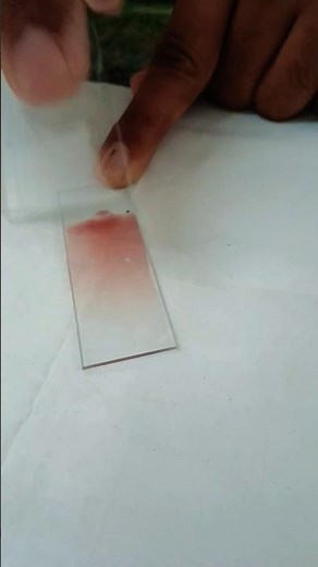 Making a peripheral blood smear | blood smear preparation | prepare a perfect blood smear|Hematology