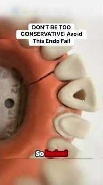 DON’T BE TOO CONSERVATIVE: Avoid This Endo Fail