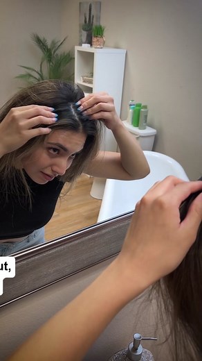 Bid dry scalp goodbye 👋🏼 #dryscalp #itchyscalp #hairhack #dryscalpremedy #dandruff