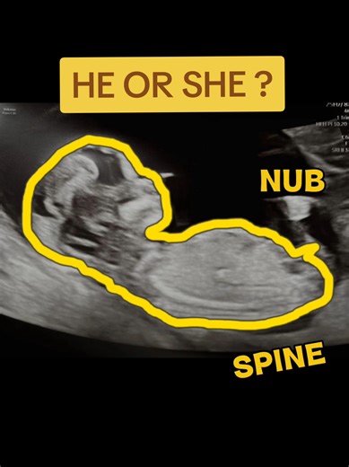 Can You Guess the Baby's Gender? Pink or Blue Challenge!