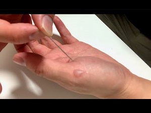 [Viewer discretion advised] I stuck a needle into a swollen blister...