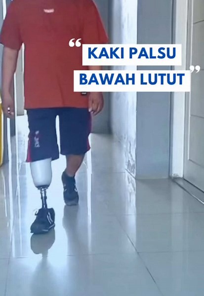 Kaki Palsu Nyaman untuk Pengguna Amputasi