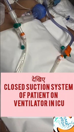 HOW TO DO CLOSED SUCTION OF PATIENTS IN ICU#@SmartMedicalKnowledge
