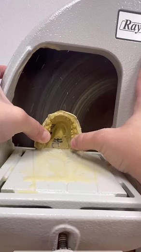 1.1M views · 5.9K reactions | #dentaltech #dentallab #dental | Dental Technician | Facebook