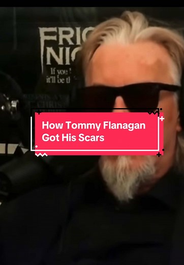 How #tommyflanagan got his scars #chibs #chibstelford #sonsofanarchy #interview Credit: Inside of You Clips - YT