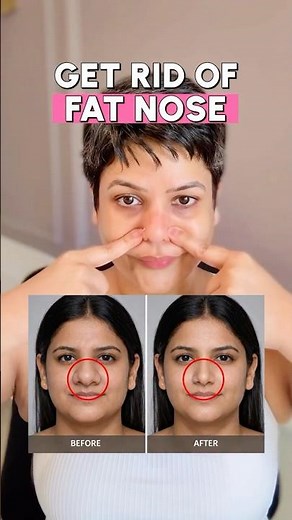 Get rid of FAT nose