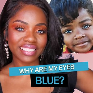 9.9M views · 223K reactions | Why Do I Have Blue Eyes? The TRUTH! | Cydnee Black | Facebook