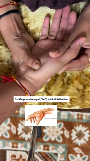 Dr. Drashti Jotaniya on Instagram: "✨ THUMB PAIN? CMC MOBILISATION MAY BE THE GAME-CHANGER. If you or your patients struggle with pain at the base of the thumb, difficulty in pinching, gripping, writing, texting, or early thumb arthritis, the 1st CMC joint mobilisation can make a huge difference. The 1st CMC joint (thumb base) is a saddle joint, designed for mobility — but that also means it easily becomes stiff, irritated, or overloaded. Mobilising it restores smooth gliding, reduces pain, and 