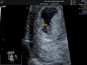 2.9K views · 65 reactions | The 4D Ultrasound Lady on Reels | Facebook
