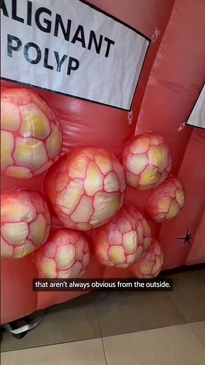 Inside of a Giant Colon - Colon Cancer Awareness