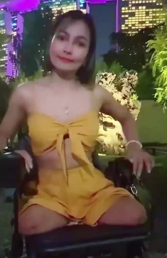 Wheelie Beautiful Lady: Inspiring DAK Amputee Story