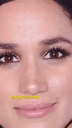 Meghan Markle Face Sculpting Mystery Fillers Botox And Changing Features Debate