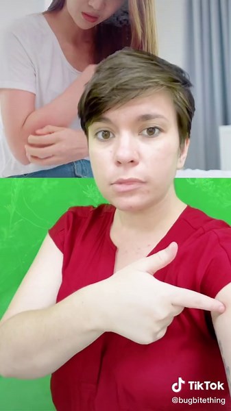 How Does Bug Bite Thing Work? Suction vs. Chemicals Explained