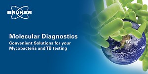 LiquidArray® technology for TB / Mycobacteria diagnostics and beyond