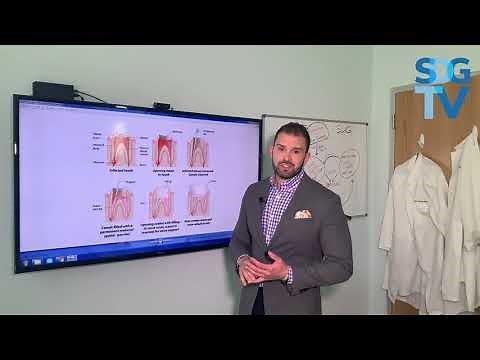 Why Would I Need a Root Canal? | Spodak Dental Group