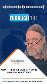 What the First Days in a Burn Unit Are Really Like