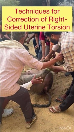 Uterine torsion l Techniques for Correction of Right-Sided Uterine Torsion l dr Umar khan