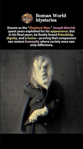 Joseph Merrick Found Kindness After a Lifetime of Exploitation