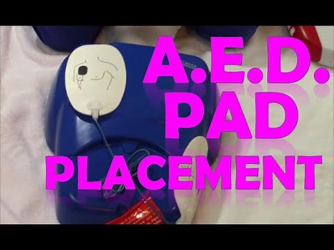 AED Pad Placement | How to Use Defibrillator Pads