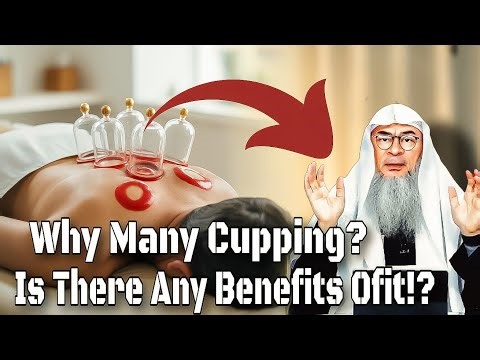 What Are The Benefits Of Cupping According In Islam!? Also What Days Are Recommended For It!? #assim