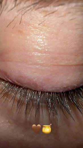 Honey Brown Eyes Color Trends | Eye Harmony