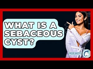 What Is A Sebaceous Cyst? - Skin Savvy Dermatology