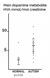 Dopamine Excess and/or Norepinephrine and Epinephrine Deficiency in Autistic Patients Due to Prenatal and/or Postnatal Deficiency of Dopamine Beta-Hydroxylase