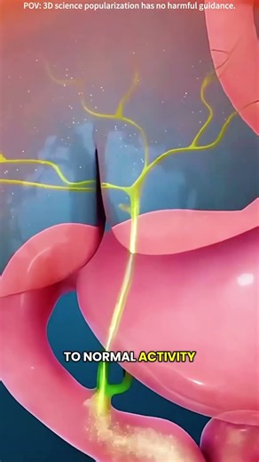 How gallbladder removal surgery is performed?(3D animation) #drone #theflash #space #automobile